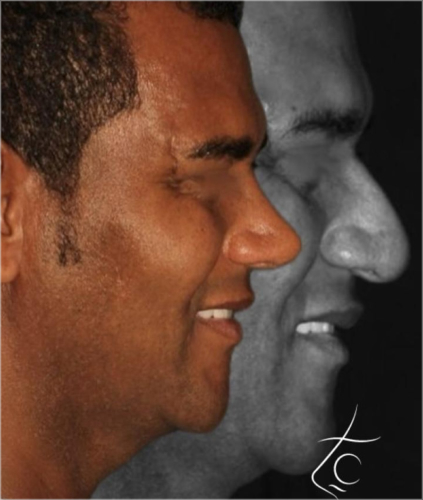 CS5